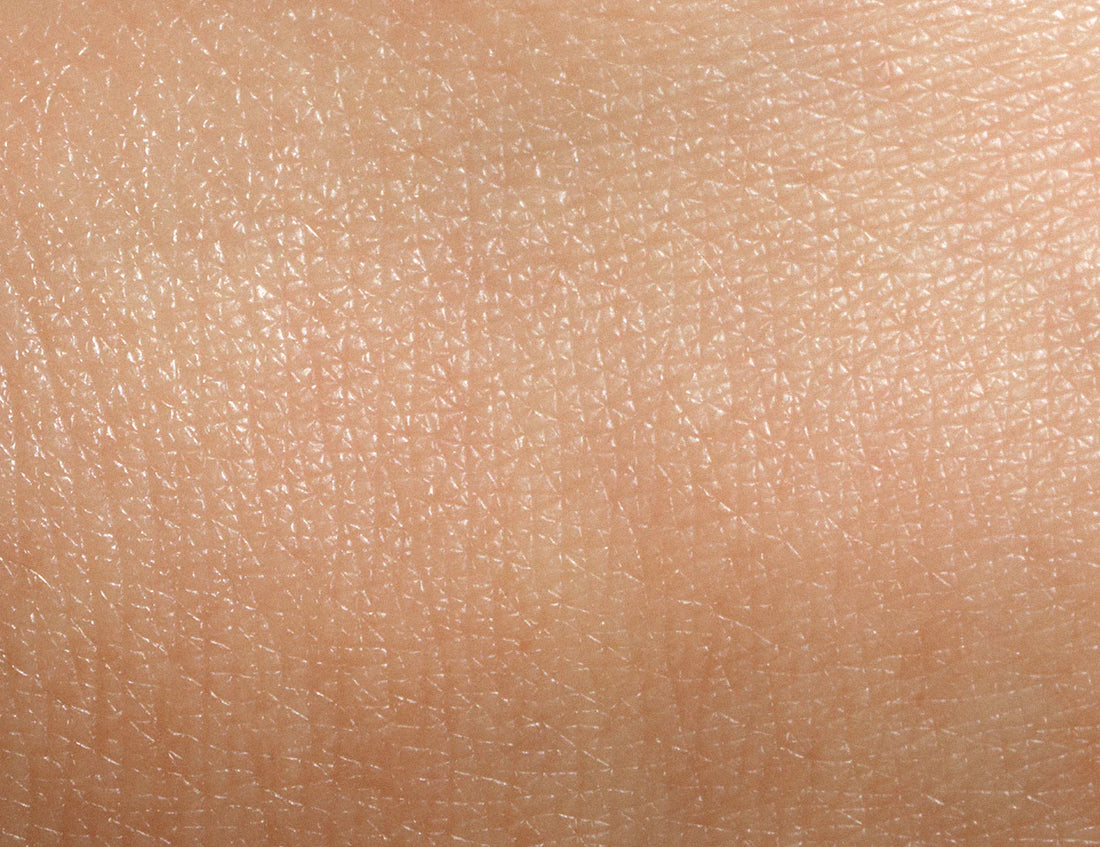 Inflammatory skin conditions and nutrition