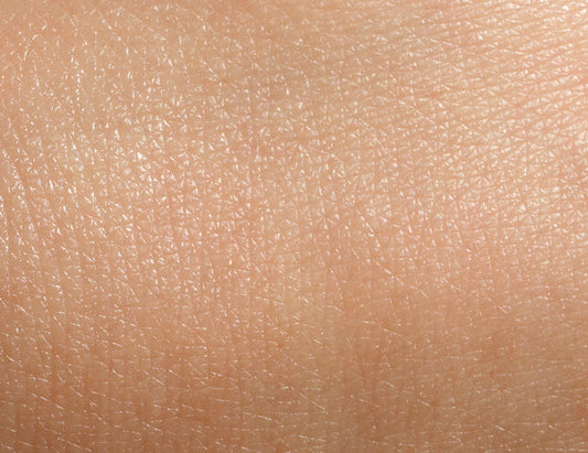 Inflammatory skin conditions and nutrition